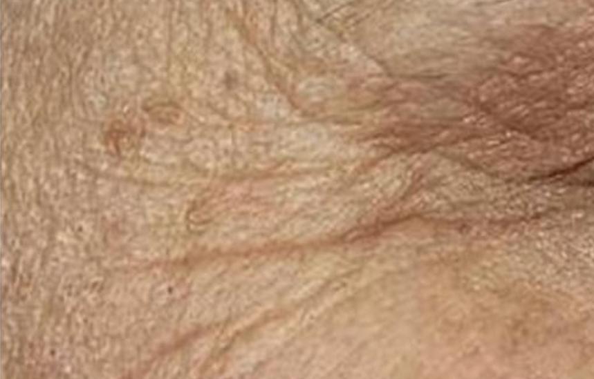 Skin Ethik Rides Avant