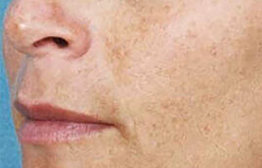 Skin Ethik visage avant