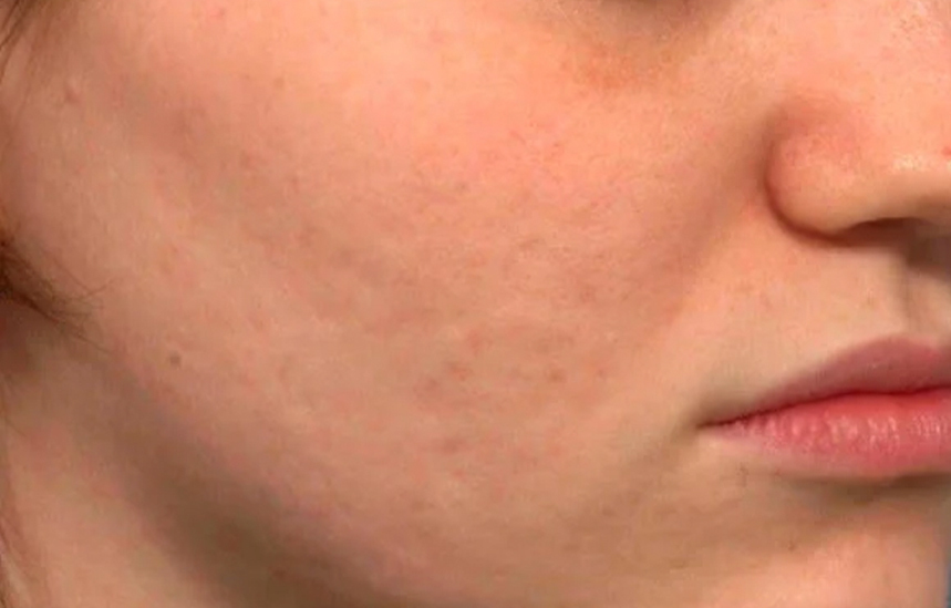 Skin Ethik visage 1 avant